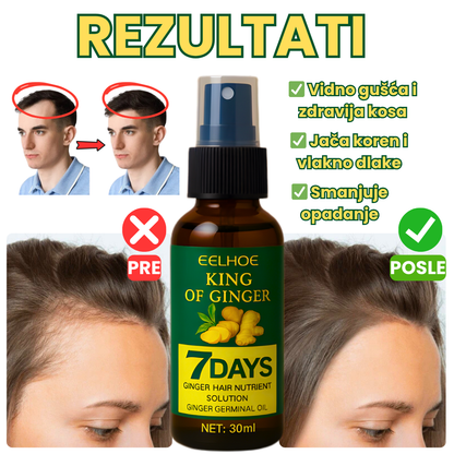 BioGrow - 100% Prirodni Serum za rast kose