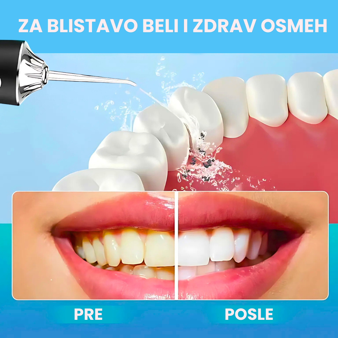 Profesionalni Tuš za zube – oralna higijena